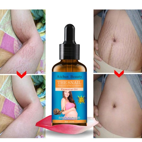 Aichun Beauty The Snail Removes Stretch Marks Essential Oil For Discount