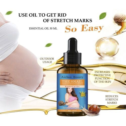 Aichun Beauty The Snail Removes Stretch Marks Essential Oil For Discount