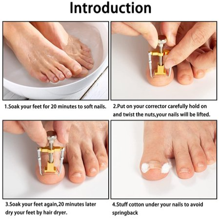 Pack of 2 - Ingrown Toe Nail Correction Tool - Gold Discount